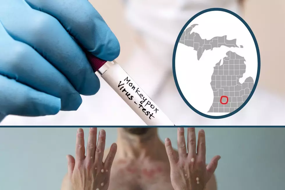 Monkeypox Has Entered a West Michigan County With Its First Case