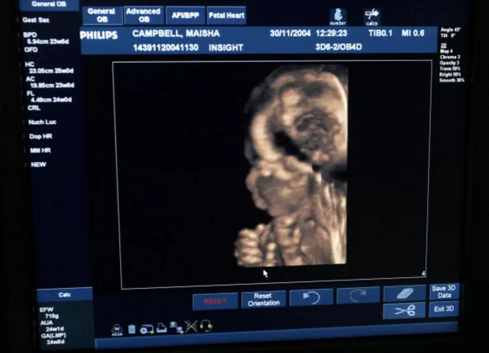 Amazing Ultrasound Shows Baby Clapping [Video]