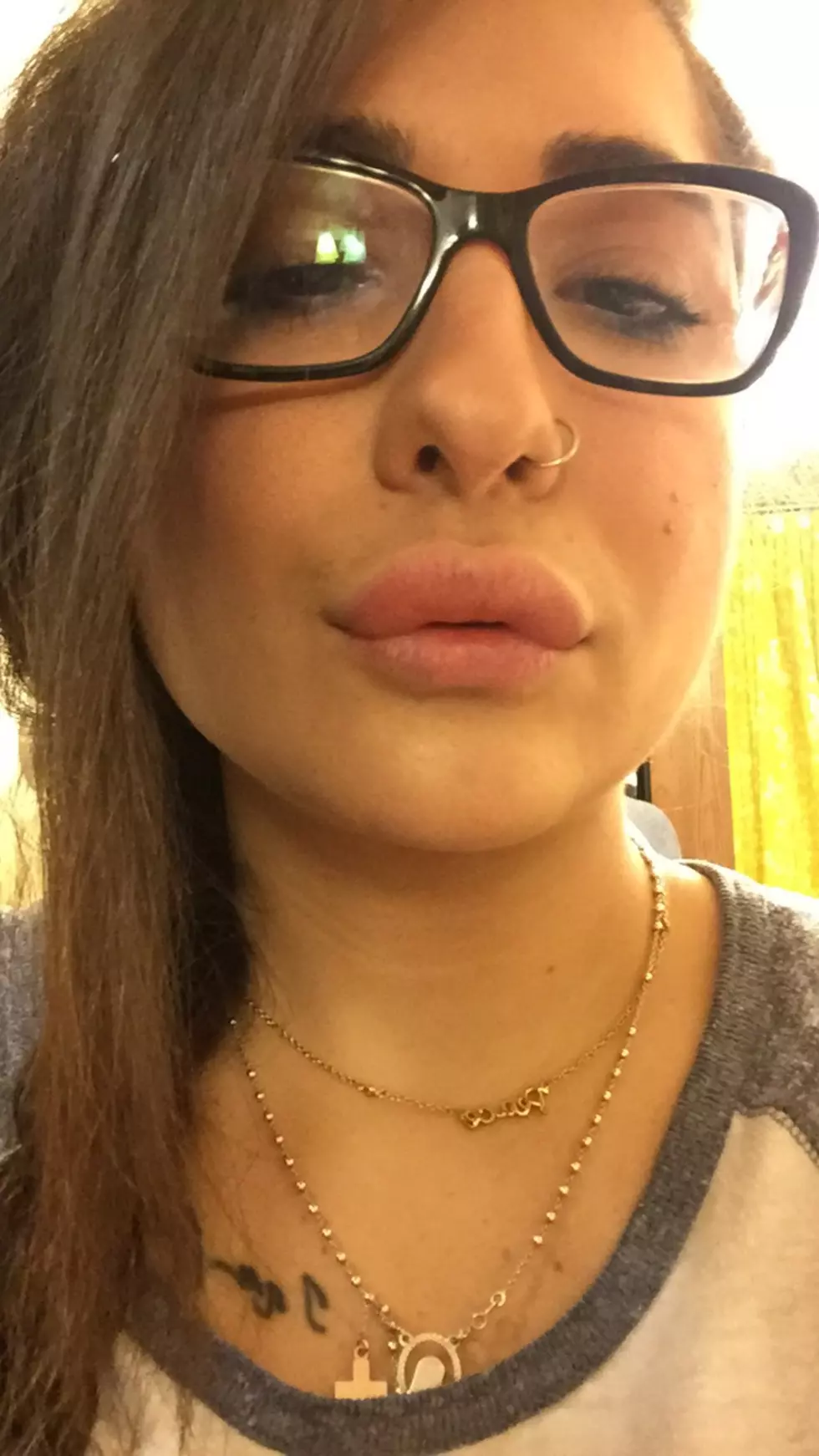 I Had Kylie Jenner Lips for a Day (Sort of) [Pictures]