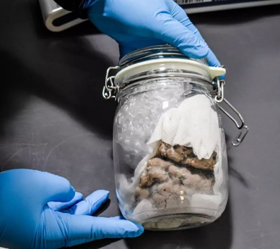 Human Brain Inside of a Jar Seized by U.S. Customs in Michigan