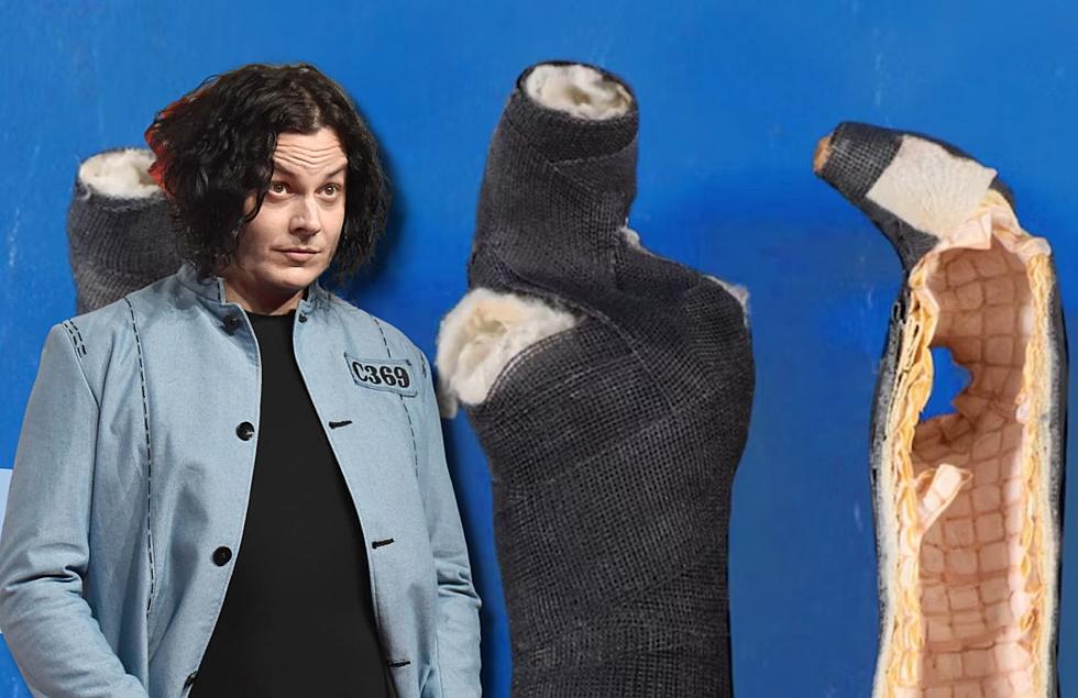 You Can Now Buy Jack White’s Finger Casts From His Detroit Car Crash