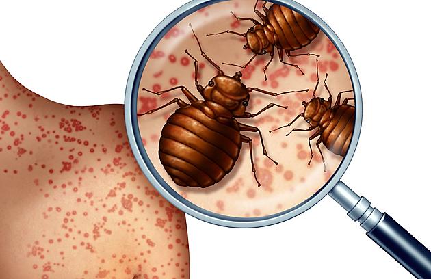 Bed Bug Bites vs Spider Bites: How to Differentiate the Two– Bed