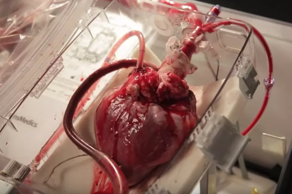 University of Michigan Device Keeps Transplant Hearts Beating While in Transit [Video]