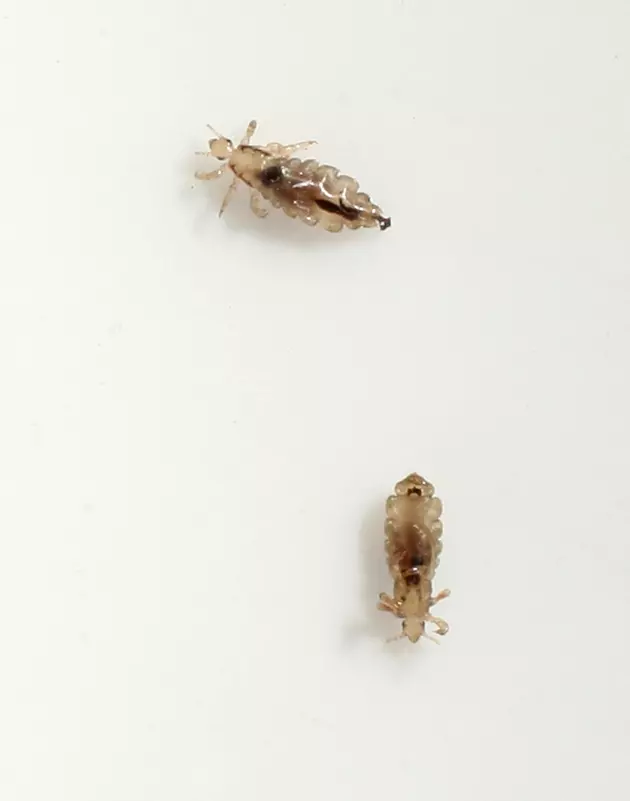 Head Lice Season Is Upon Us! Here&#8217;s Some Ways To Avoid The Itch
