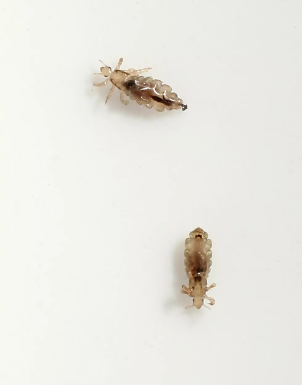 Head Lice Season Is Upon Us! Here’s Some Ways To Avoid The Itch