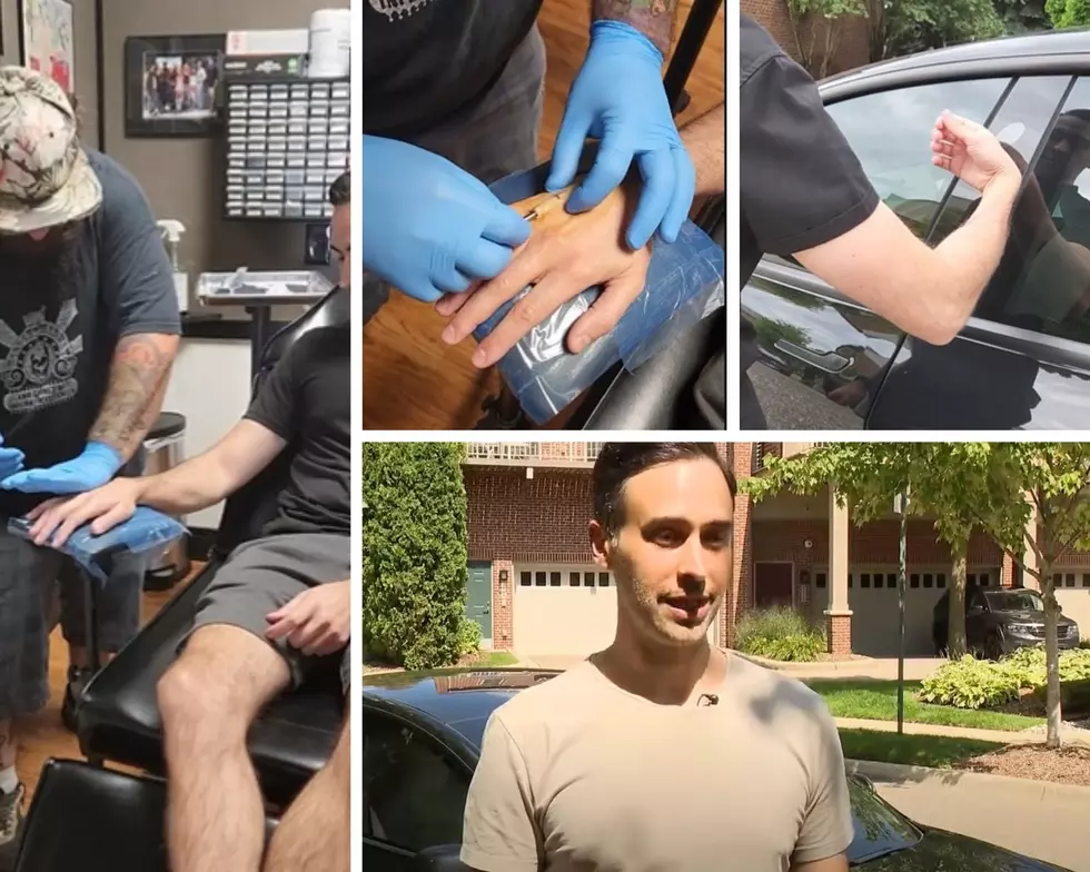 Detroit Man Gets His Car And House Keys Implanted Into His Hand