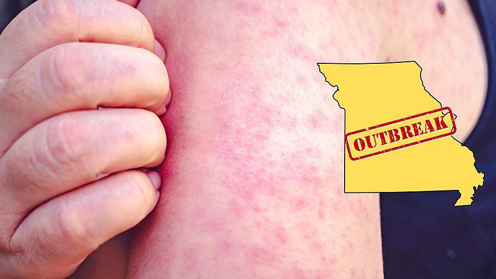 Missouri Slammed by Measles Outbreak &#8211; Dangerous for Children