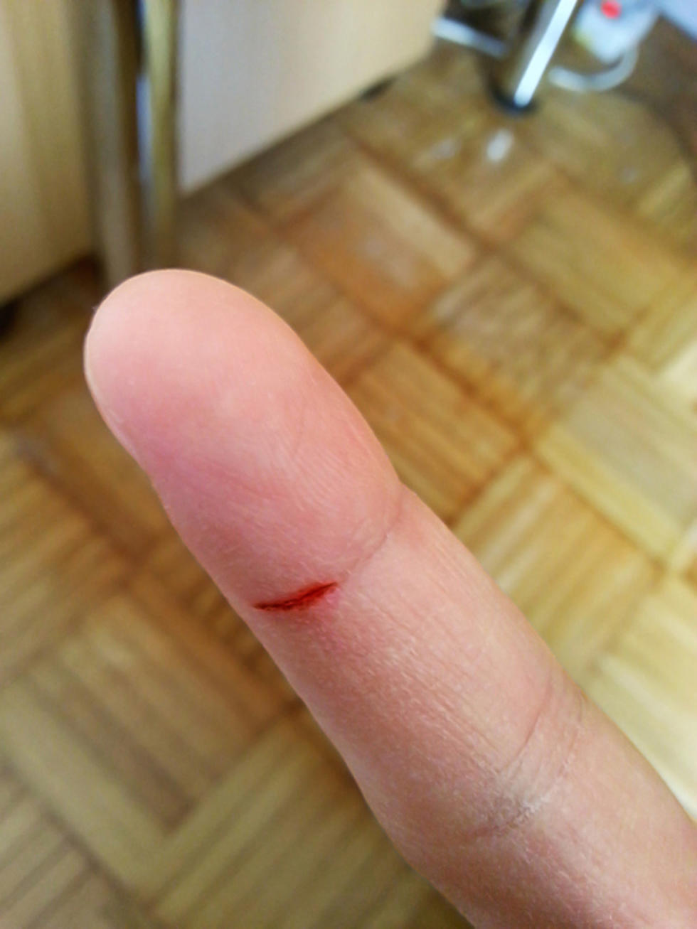 Here’s Why Paper Cuts Hurt So Much