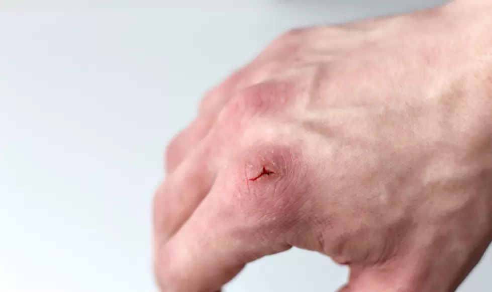 Here&#8217;s Why Paper Cuts Hurt So Much
