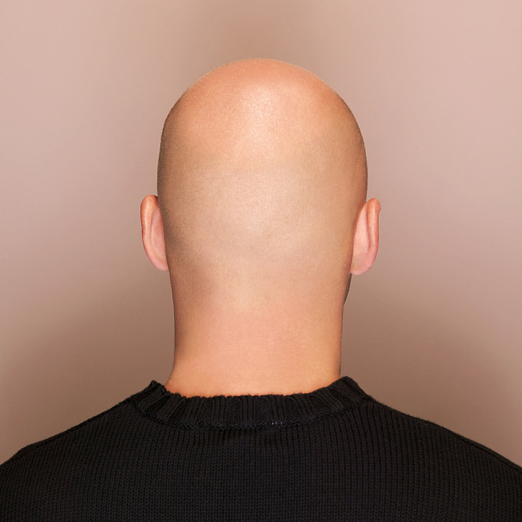 Life As A Bald Man!