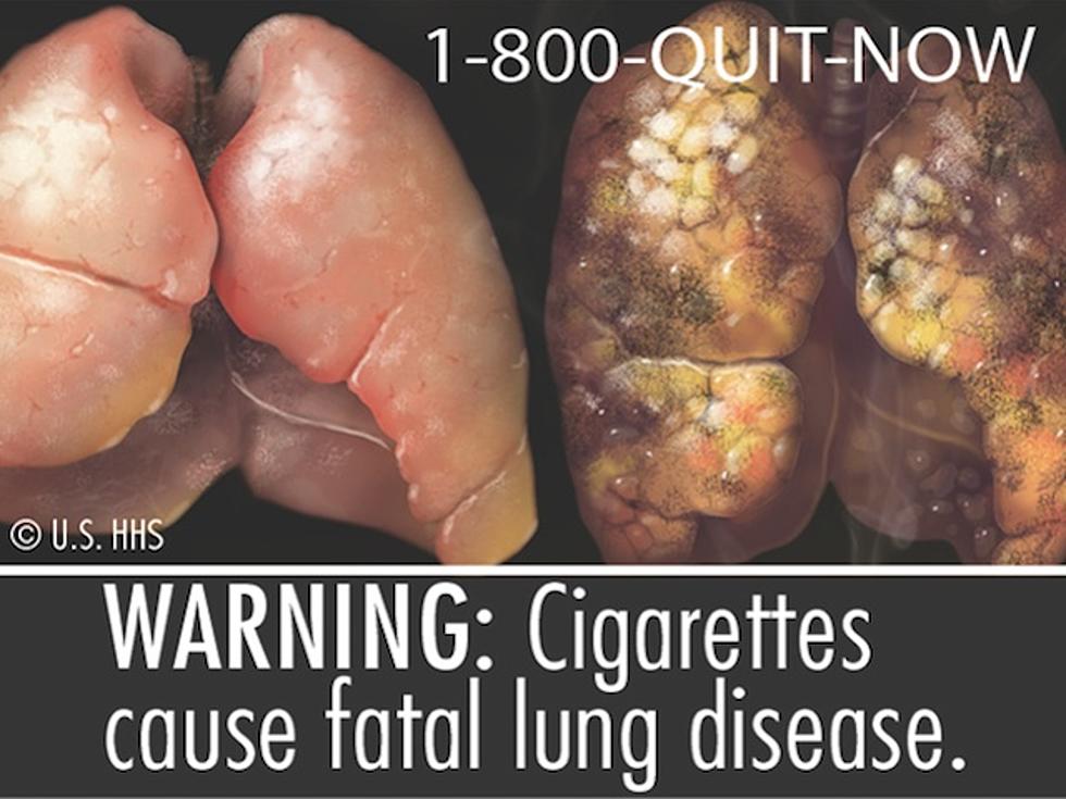 Tobacco Companies Sue to Block Graphic Warning Labels [VIDEO]