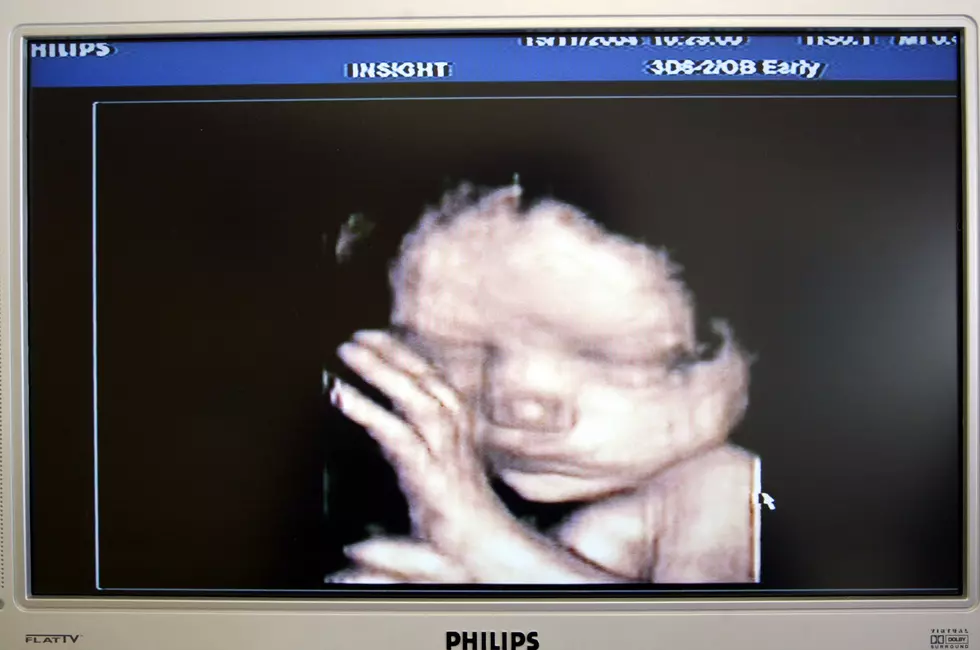 4D Fetal Pictures and Smoking Mothers, Does This Intrigue or Disturb You? [VIDEO]