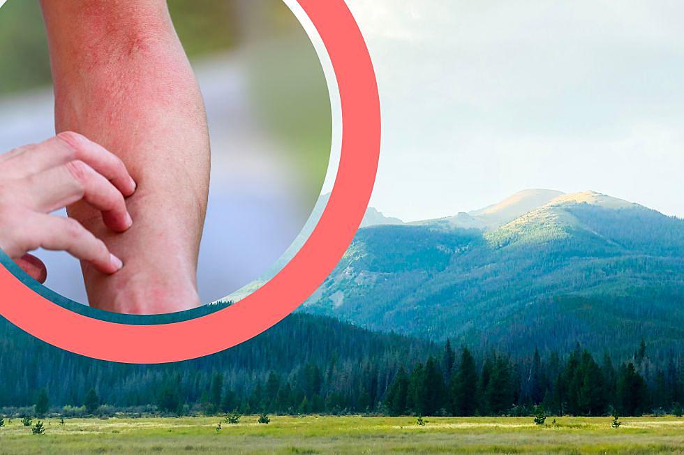 Got a Mosquito Bite in Colorado? Here Is How to Ditch the Itch