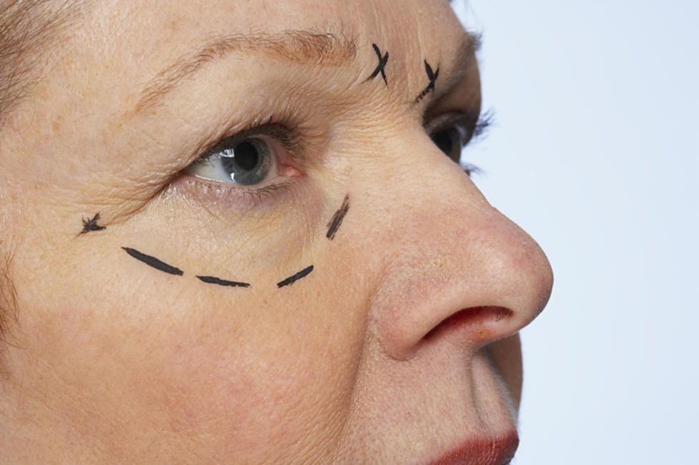 Selfie Craze Results in Botox Boom