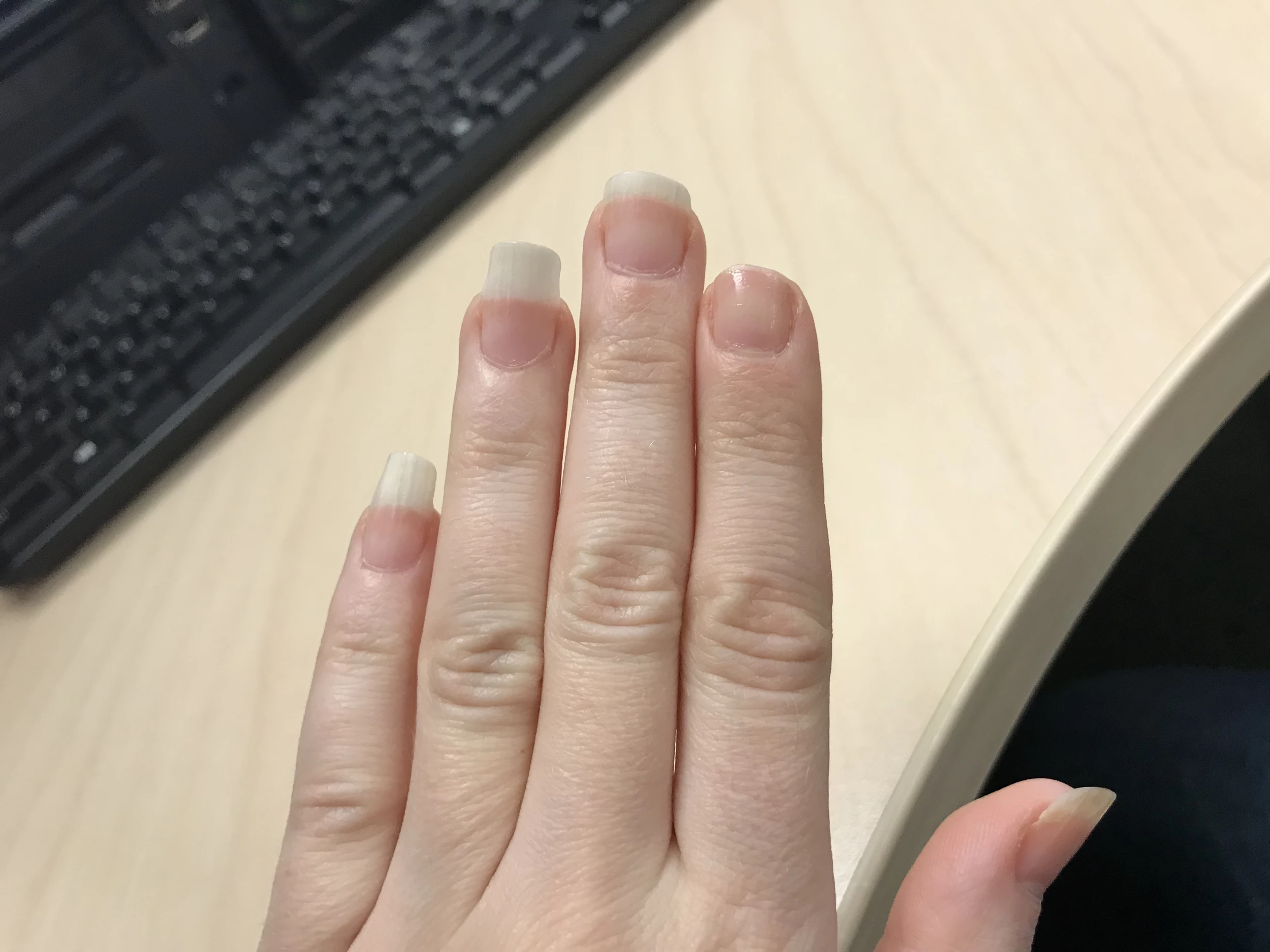 Split Nails, Repairing, Treating & Preventing, Everything You Need To Know