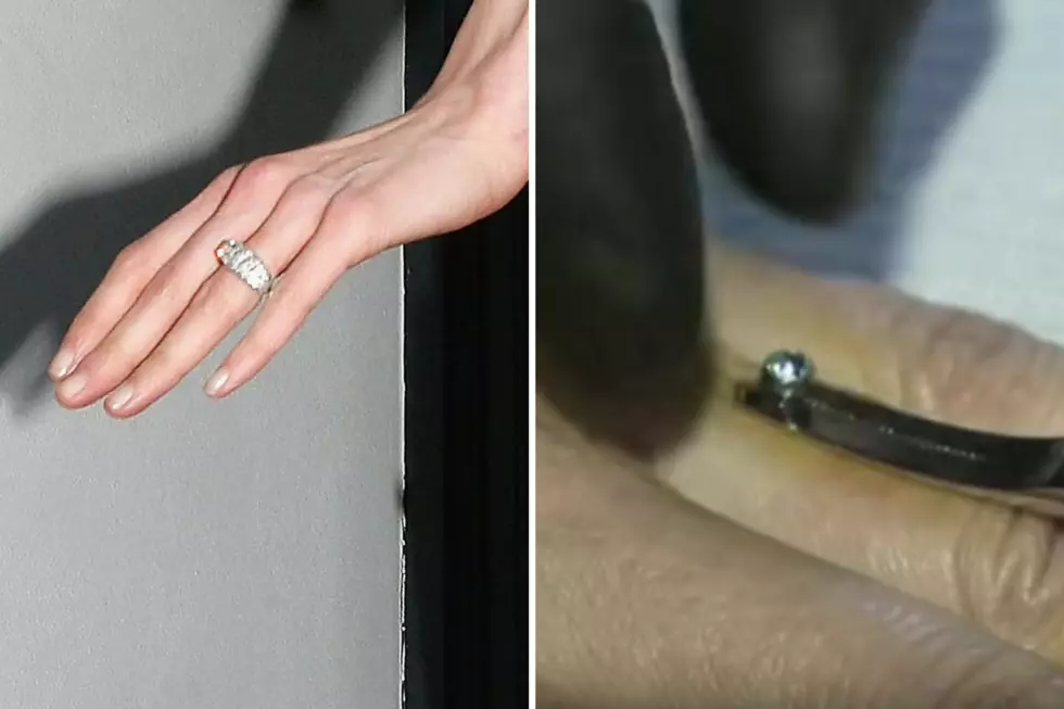 New Trend? Get Your Engagement Ring Embedded in Your Finger