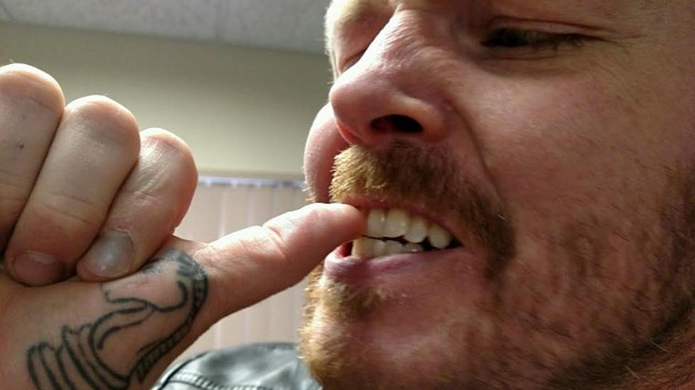 Chewing Your Fingernails Isn&#8217;t a Bad Habit, It Could Be a Mental Disorder