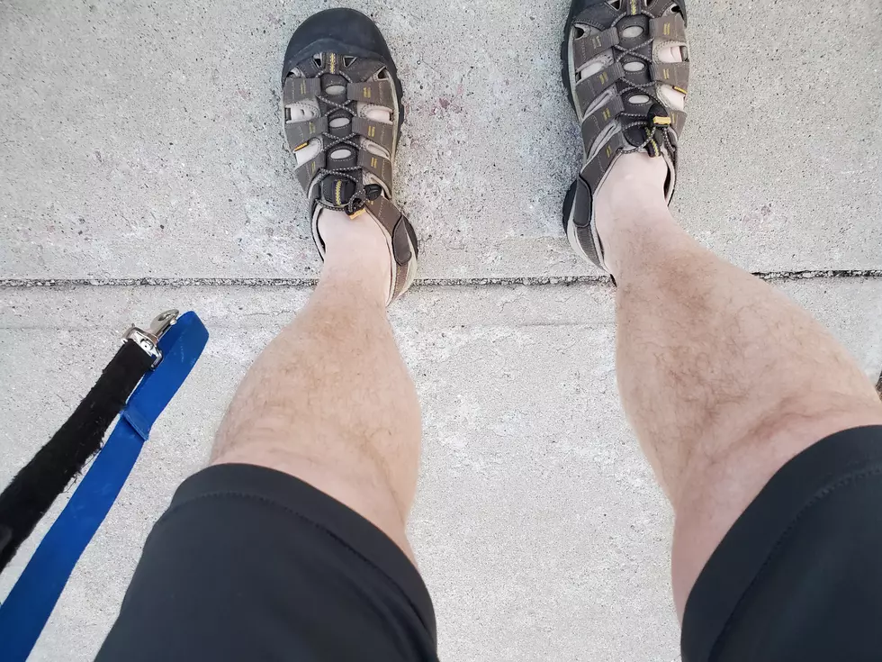 Warmer Weather Brought out the Shorts. And it Wasn’t Pretty!