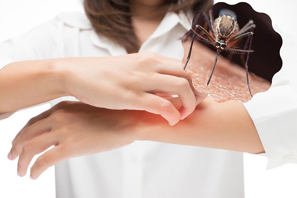 Hey South Dakota, Here&#8217;s How to Ditch the Itch of a Mosquito Bite