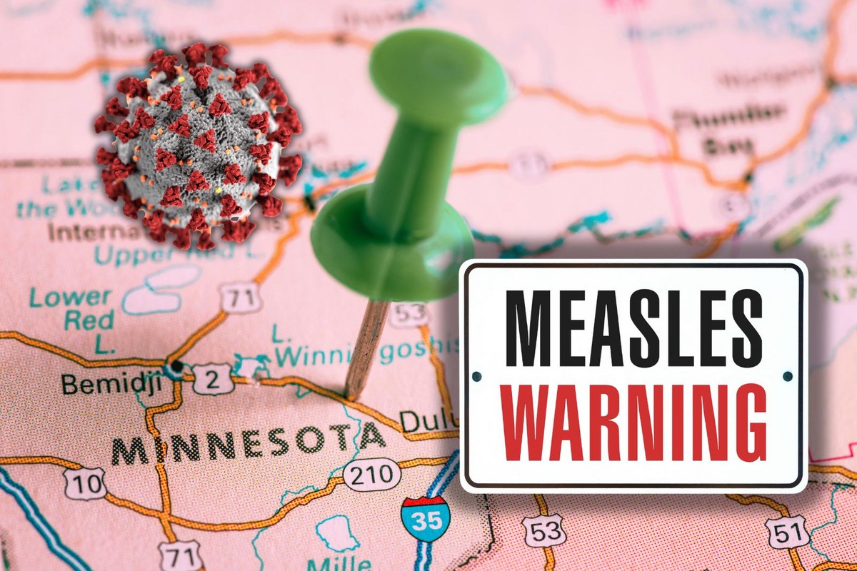 Measles Cases Are Surging Across Minnesota