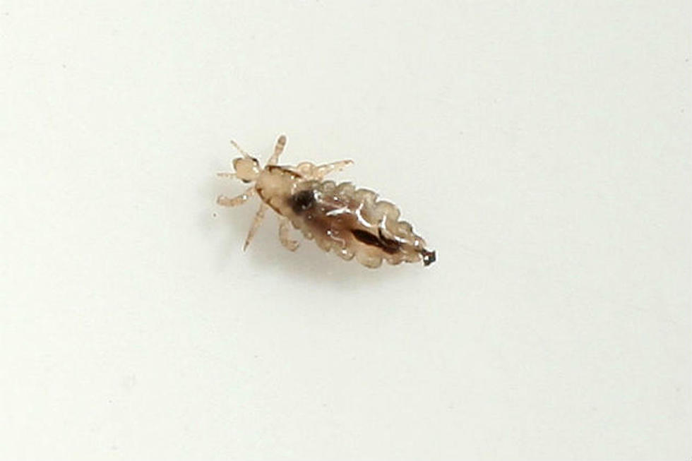98% of Lice Immune to Popular Treatments