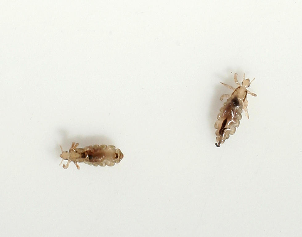 ‘Super Lice’ Outbreak Spreading Across United States