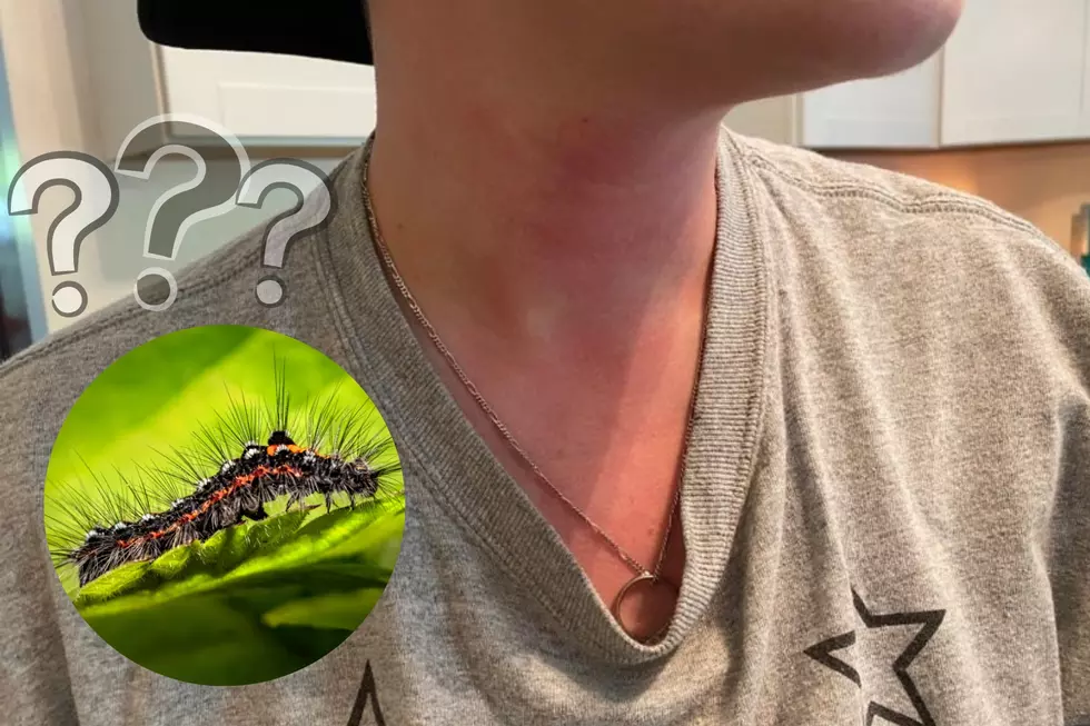 Lizzy’s Wife Has A Rash and We Need Your Help Identifying It