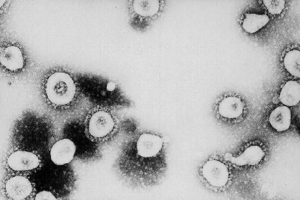 LISTEN: Dr. Nirav Shah of Maine CDC Explains Coronavirus Risks