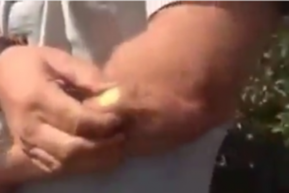 Paintball Lodges in Idiot’s Arm; Pops It Out [VIDEO]