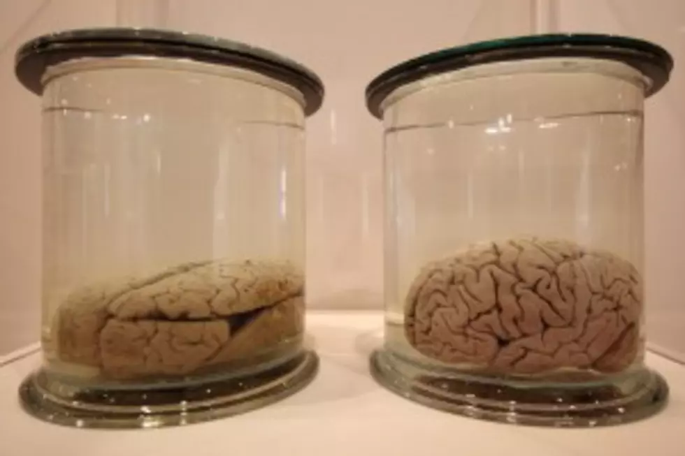 Men v Women: Who&#8217;s Brain is Bigger
