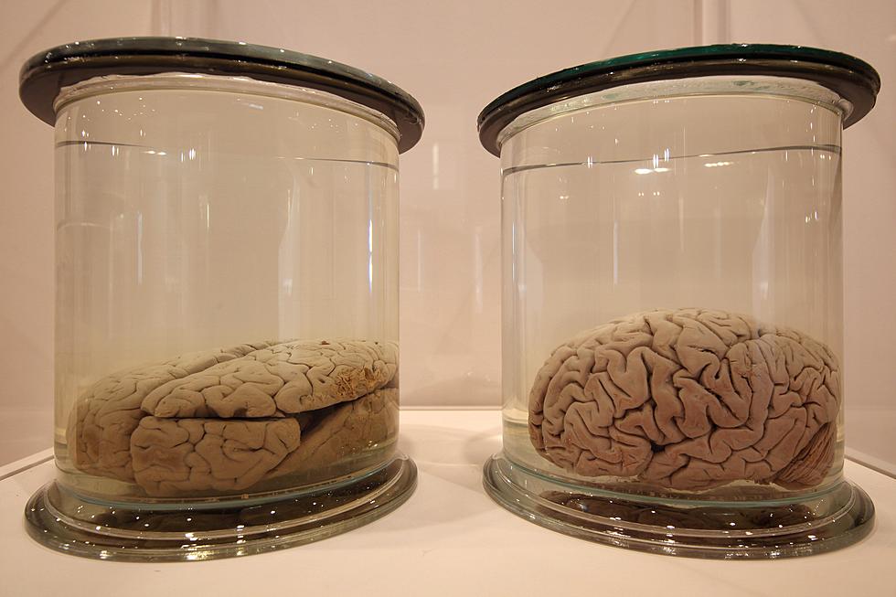 Men v Women: Who’s Brain is Bigger