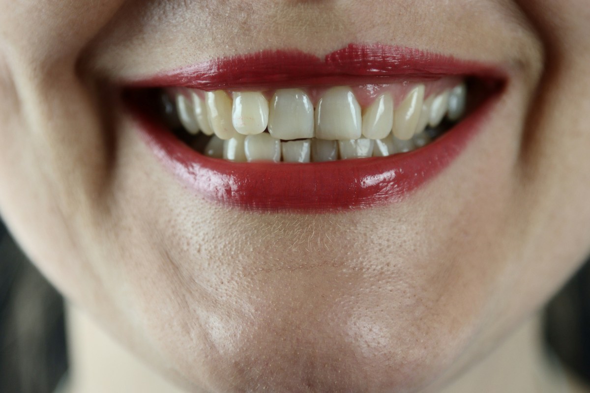 Hey New Yorkers, Let’s Talk About Weed and Your Teeth!