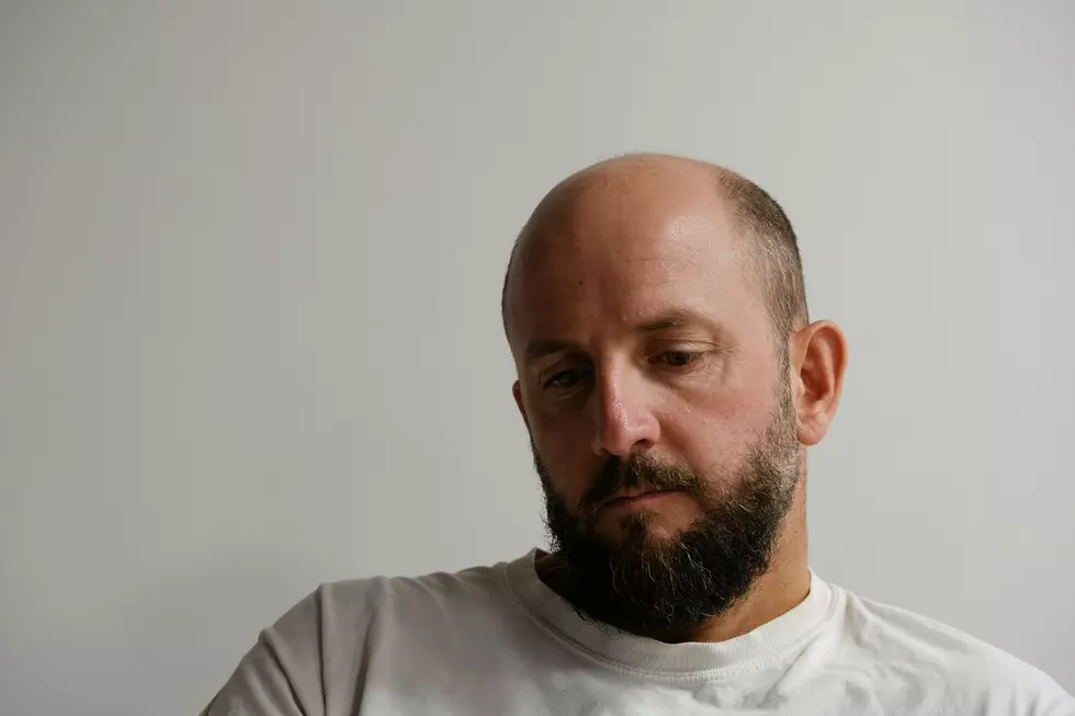 New York Ranks High for Male Hair Loss Concerns