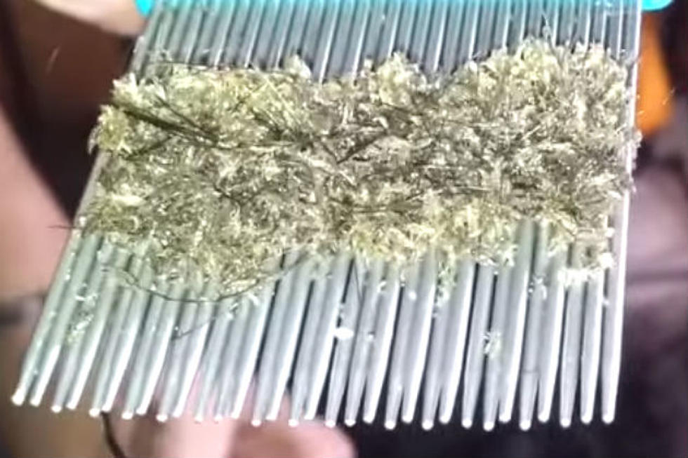 This Little Girl’s Head Lice Infestation Will Make You Sick [VIDEO]