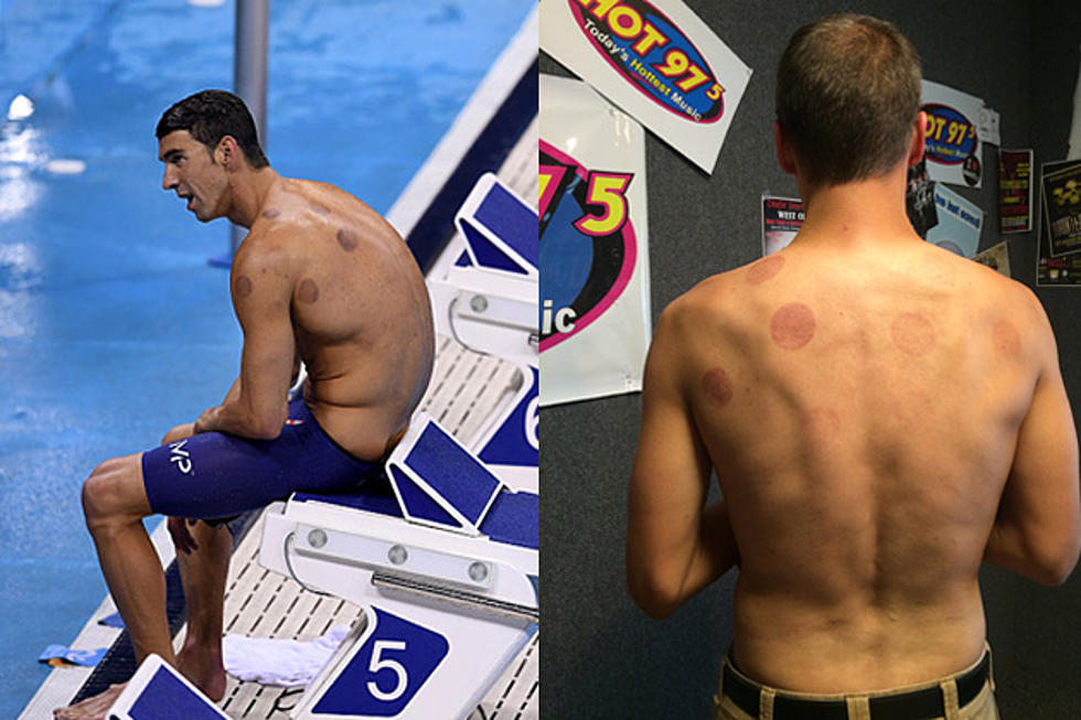 Watch Jax Do his Best Michael Phelps Impression by Trying Cupping