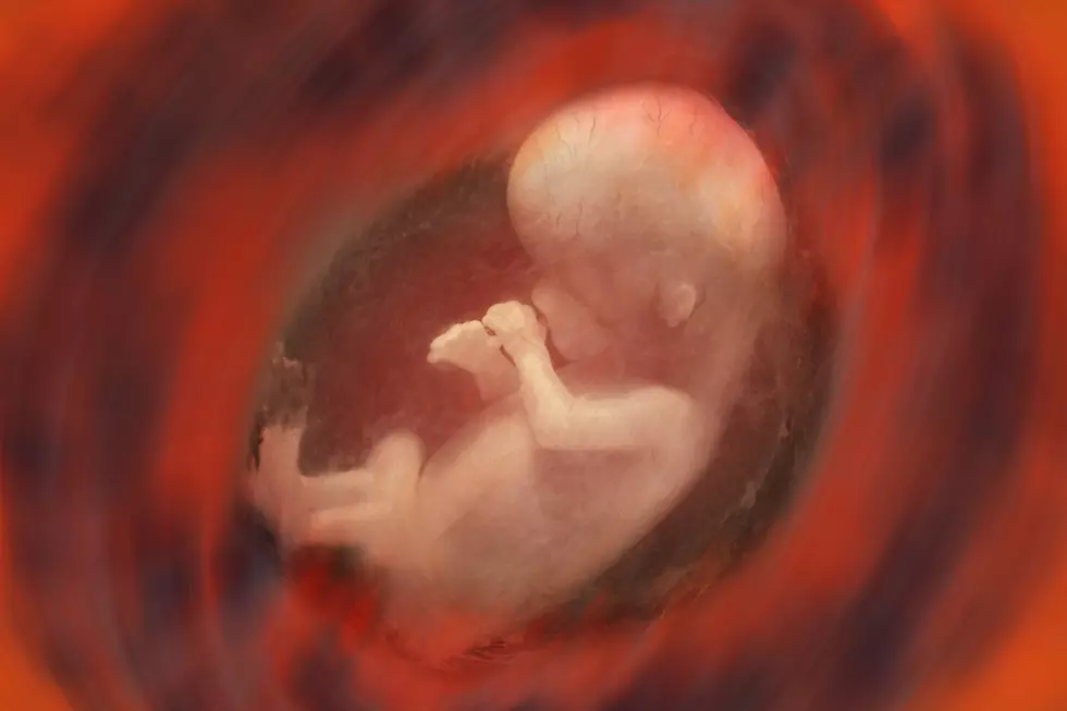 North Dakota Judge Concerned About &#8220;Master Race&#8221; Creation If Down Syndrome Fetuses Are Aborted