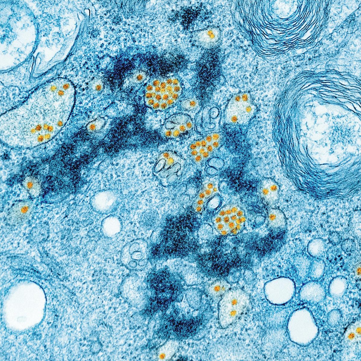 North Dakota Sees 10 Cyclosporiasis Cases So Far This Summer