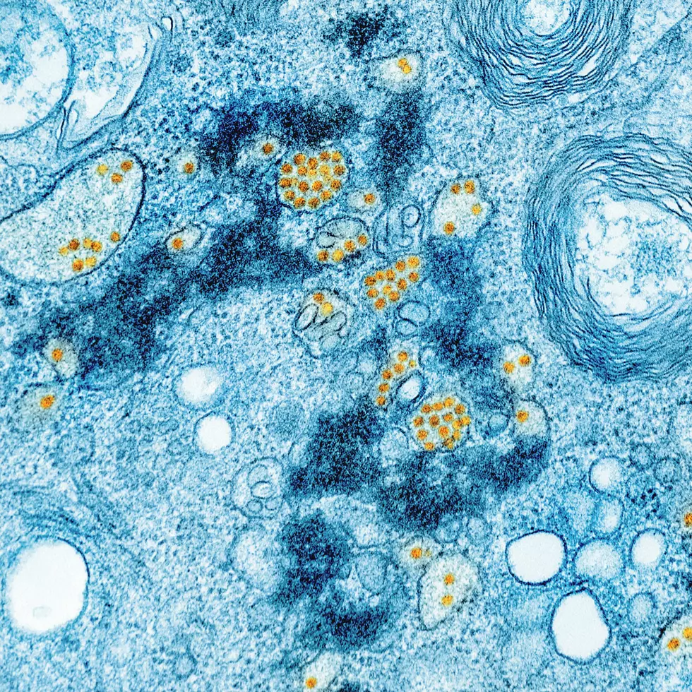 North Dakota Sees 10 Cyclosporiasis Cases So Far This Summer