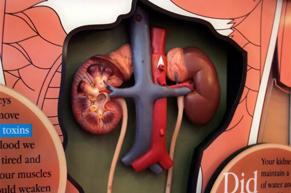 Would You Donate a Kidney to An Ex?