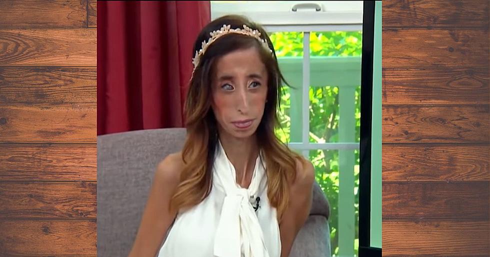 The Beauty of an Austin, TX Woman Once Called ‘Ugliest Girl in the World’