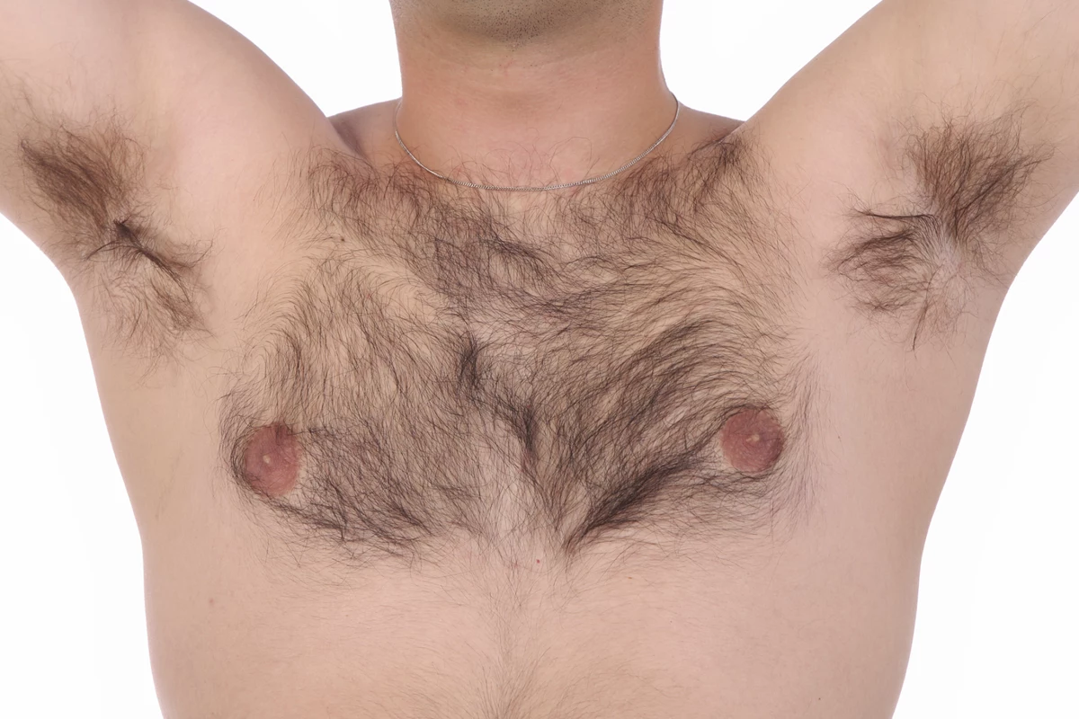 волосы на груди у мужчин форум фото 21