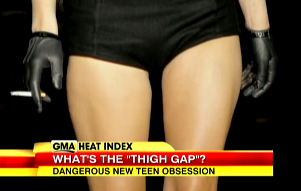 The &#8220;Thigh Gap&#8221;- Disturbing New American Teen Trend