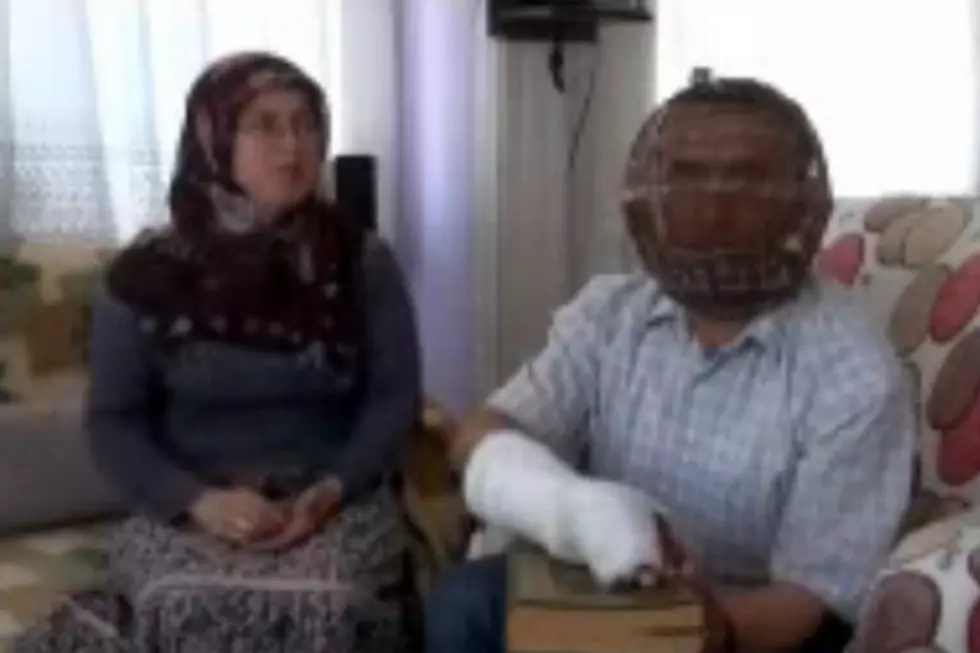 Turkish Man Tries To Quit Smoking By Caging His Head [VIDEO]