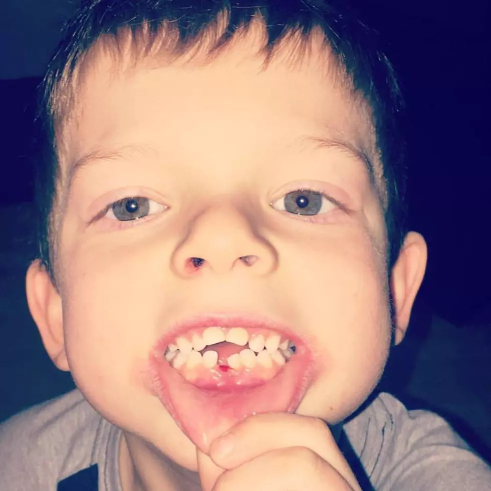 Am I the Only Mom Who Saves Her Kids&#8217; Baby Teeth?