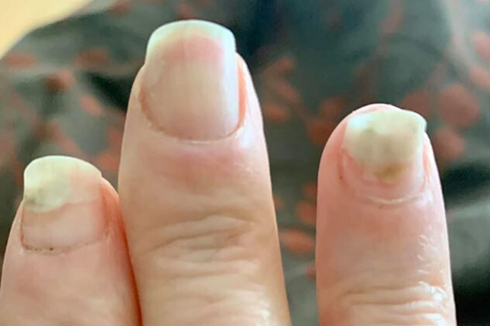 Dip Manicures Are Not Worth the Risk