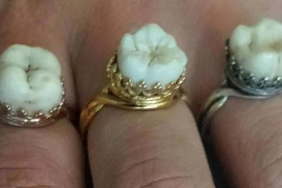 I Guess Teeth Rings Are a Thing Now