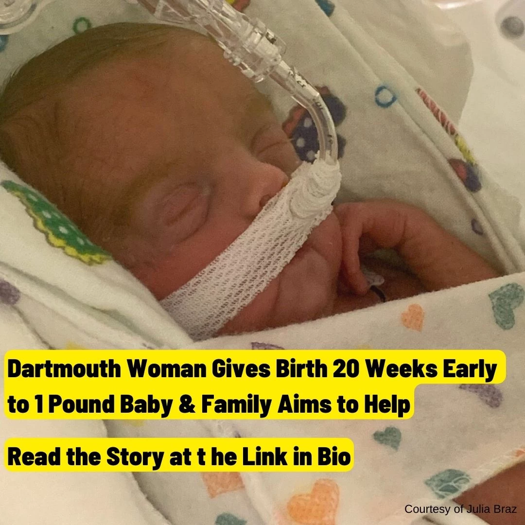 Dartmouth Woman Gives Birth 20 Weeks Early to 1-Pound Baby