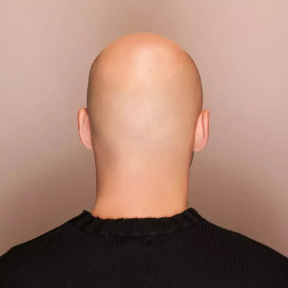 Chaser&#8217;s World Weird Web: Bald Guys Are Tattooing Hair on Their Head