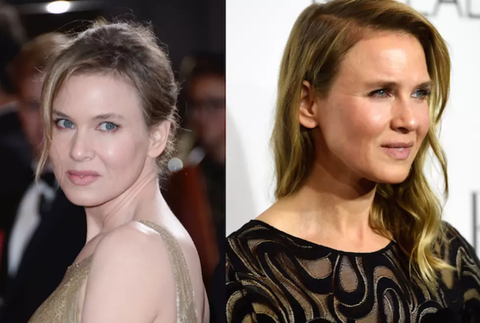 What Does Renee Zellweger and This Woman Have In Common?