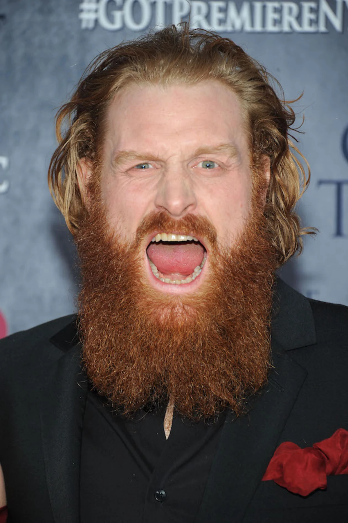Game of Thrones' Kristofer Hivju on The Last King, Beard Casting
